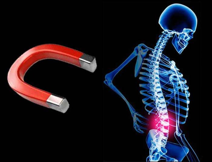 عوارض مگنت تراپی